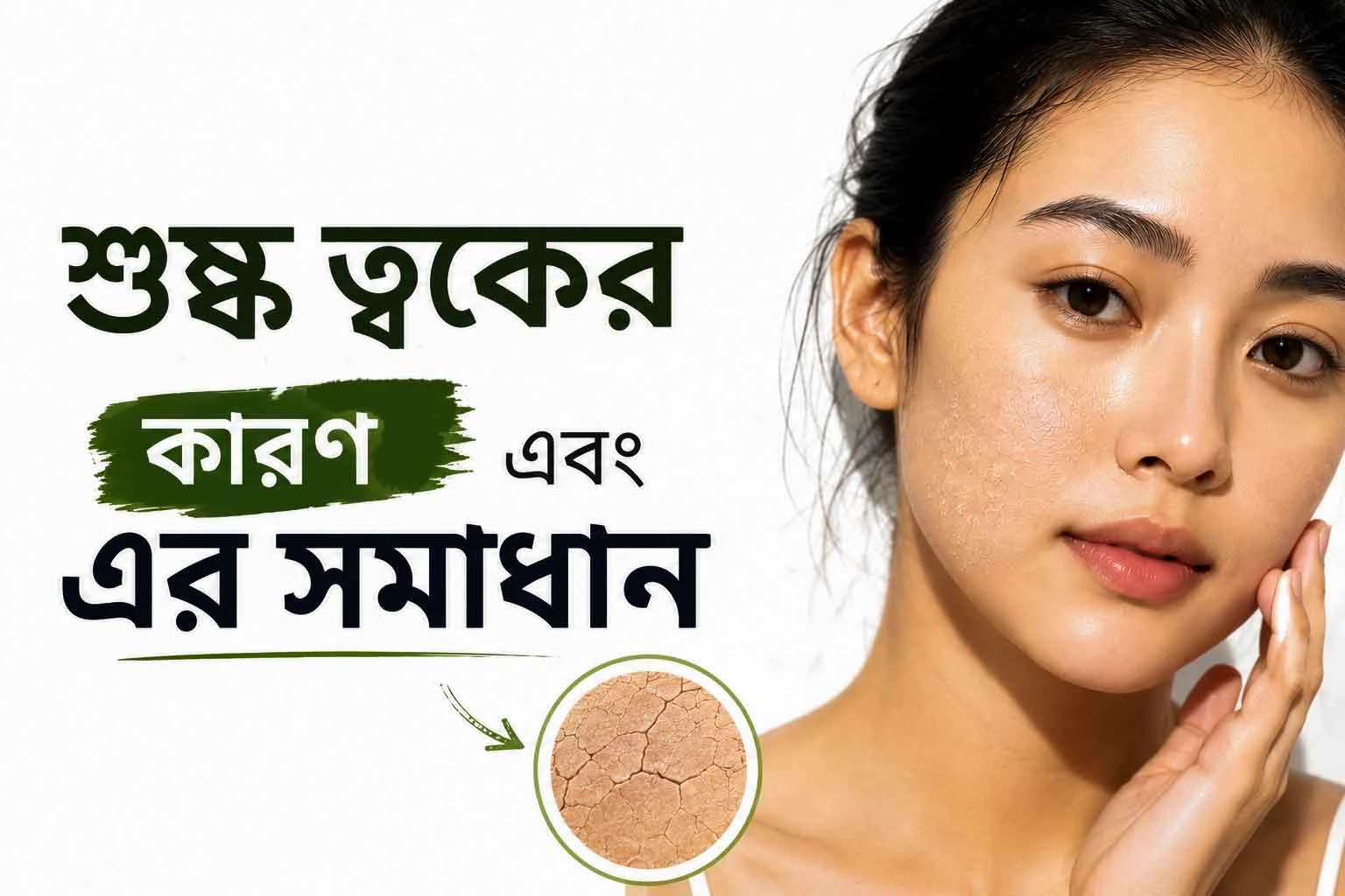 শুষ্ক ত্বক বা Dry Skin: কারণ, লক্ষণ এবং ঘরোয়া সমাধান (The Complete Guide)