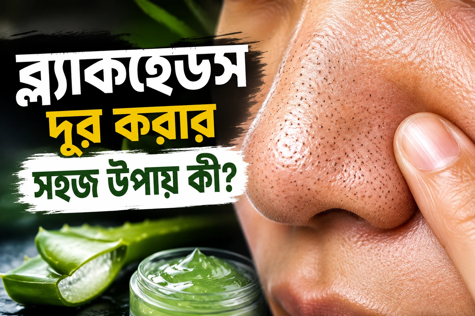 ব্ল্যাকহেডস দূর করার কার্যকরী গাইড ঘরোয়া প্রতিকার থেকে আধুনিক স্কিনকেয়ার