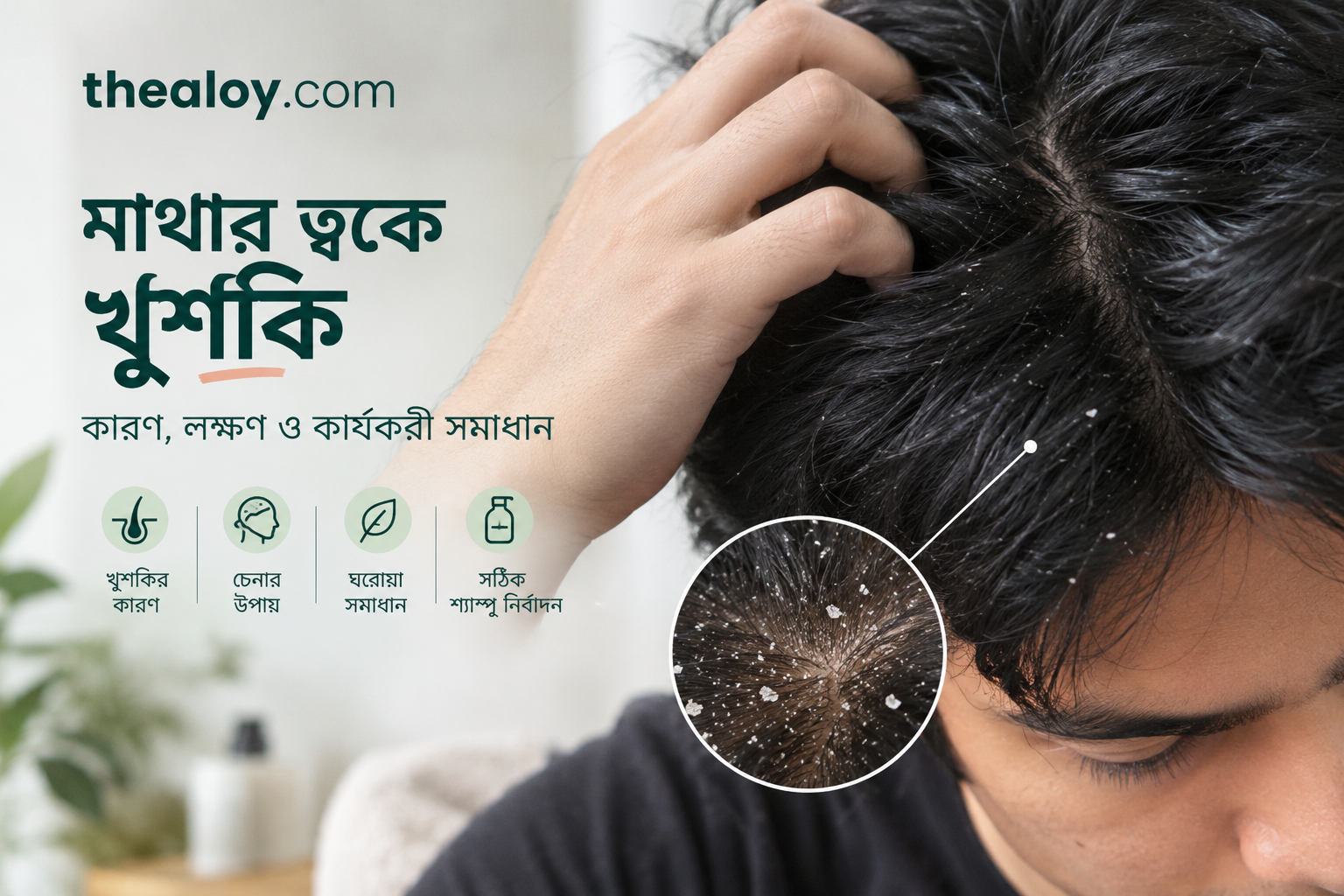 মাথার ত্বকে খুশকি: কারণ, ধরন ও দূর করার কার্যকর উপায়